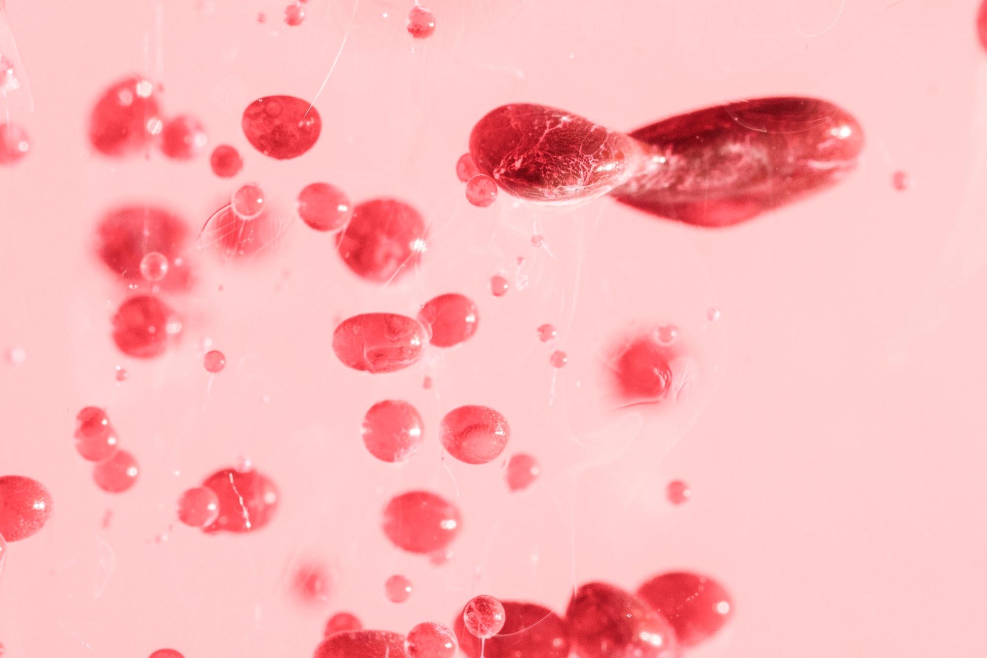Antibodies & ADCs