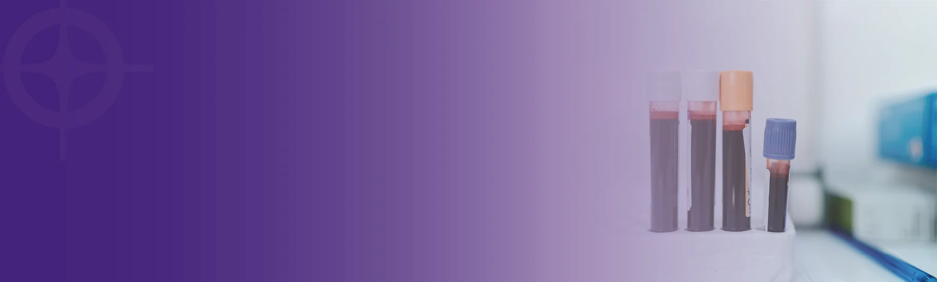 Plasma